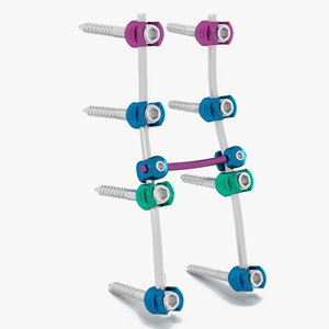3D model Lumbar Cervical Spine Fixation System Colored