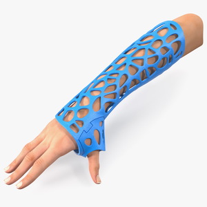 3D-Printed Orthopedic Cast On Hand 3D model