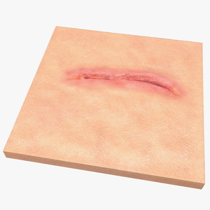 3D Cut Skin Surface