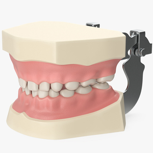 3D Pediatric Typodont Demonstration Model with Removable Gapped Teeth