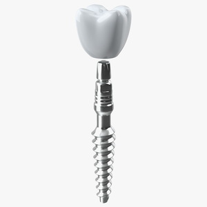 3D KOS Series Dental Implants 6 cm