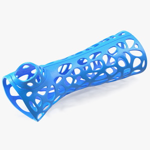 3D 3D-Printed Orthopedic Cast Hand Blue