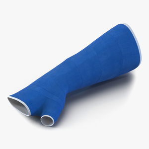 Blue Fiberglass Cast Arm 3D model