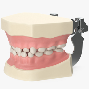 Dental Anatomy Model Simulation with Removable Crossbite Teeth 3D